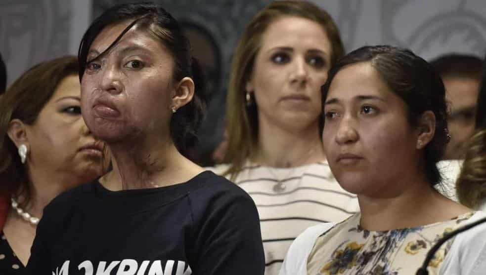 Quemaduras con ácido, ¿una práctica machista?