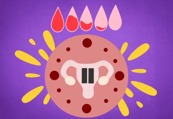 Menopausia, s&iacute;ntomas y c&oacute;mo tratarlos