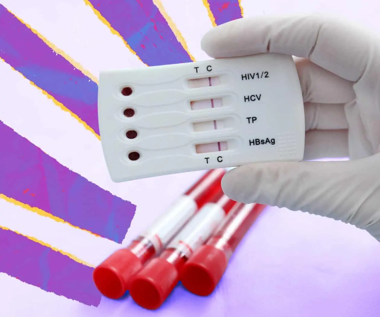 Mitos y desabasto: la doble crisis que amenaza a las personas con VIH