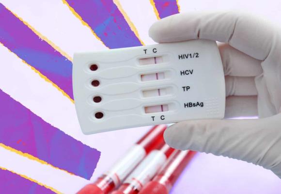 Mitos y desabasto: la doble crisis que amenaza a las personas con VIH