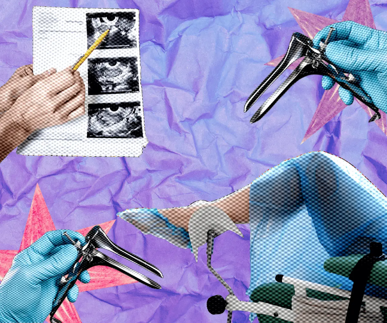 ¿Es normal que duela el espéculo vaginal? Una ginecóloga nos explica ¿Es normal que duela el espéculo vaginal? Una ginecóloga nos explica