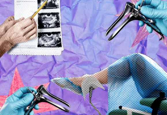 ¿Es normal que duela el espéculo vaginal? Una ginecóloga nos explica